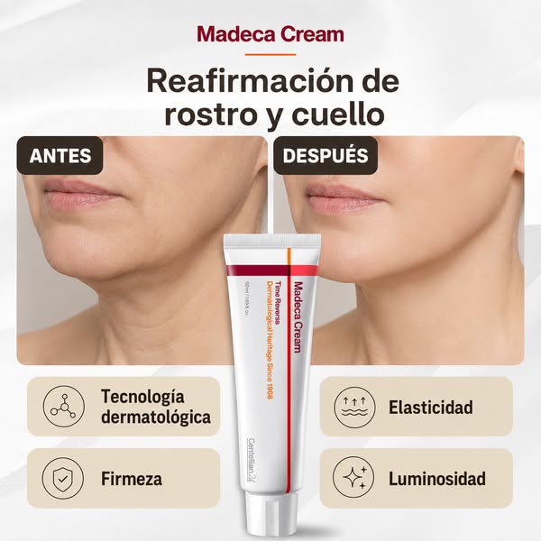 Madeca Cream - ❌Di adiós a las arrugas - 🎁 ¡Regalo incluido!