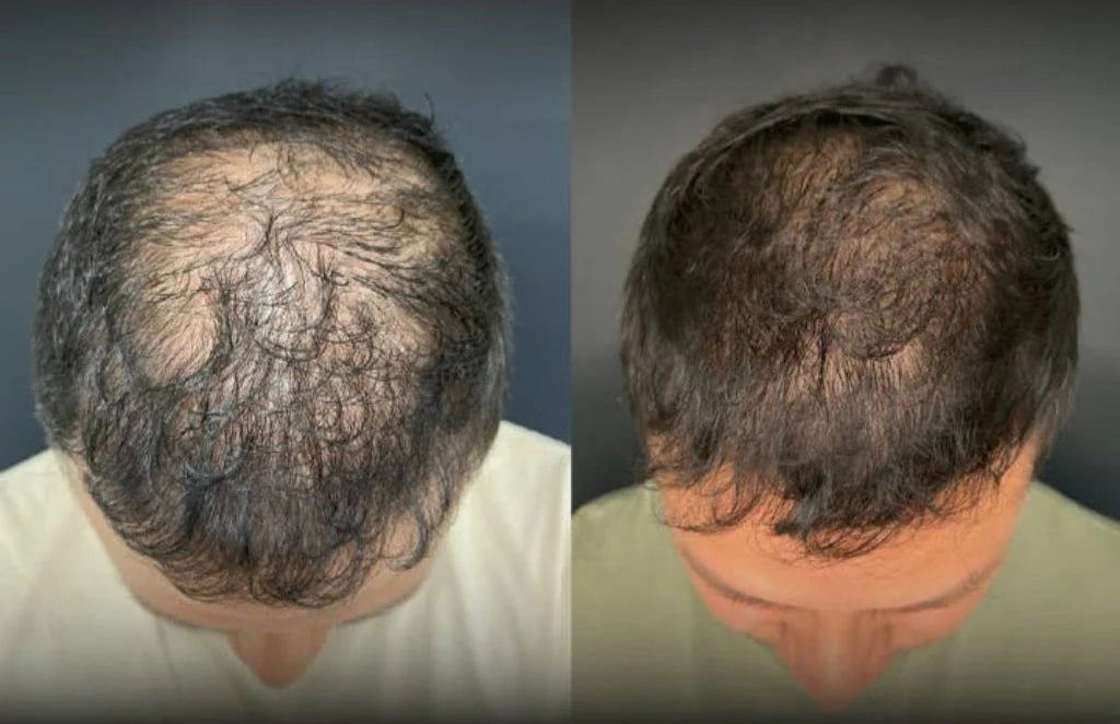 !COMPRA 1 LLEVA 2! - Aceite de batana 100% Natural para el crecimiento del cabello