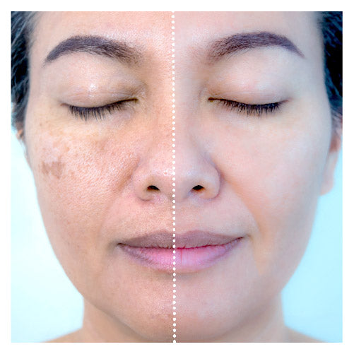 ✨The Ordinary Aha Bha 💧🌿Piel impecable y radiante - Realiza pedido y descubre la promoción