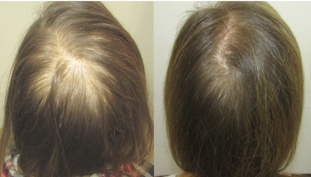 !COMPRA 1 LLEVA 2! - Aceite de batana 100% Natural para el crecimiento del cabello