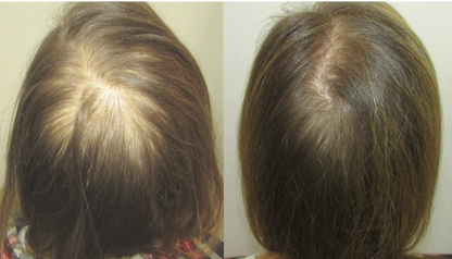 !COMPRA 1 LLEVA 2! - Aceite de batana 100% Natural para el crecimiento del cabello